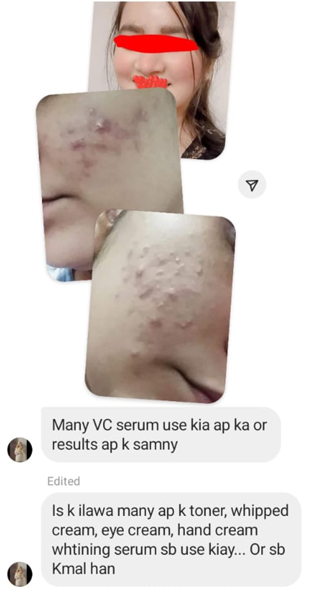 Vitamin C & E Serum